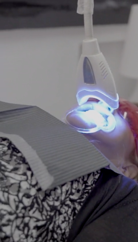 Teeth Whitening